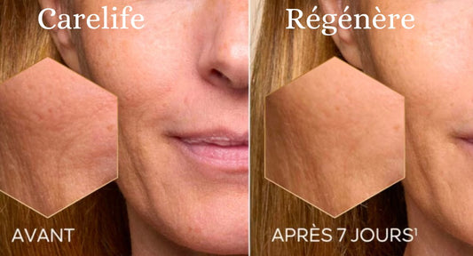 Le Mécanisme de Régénération de Carelife !!